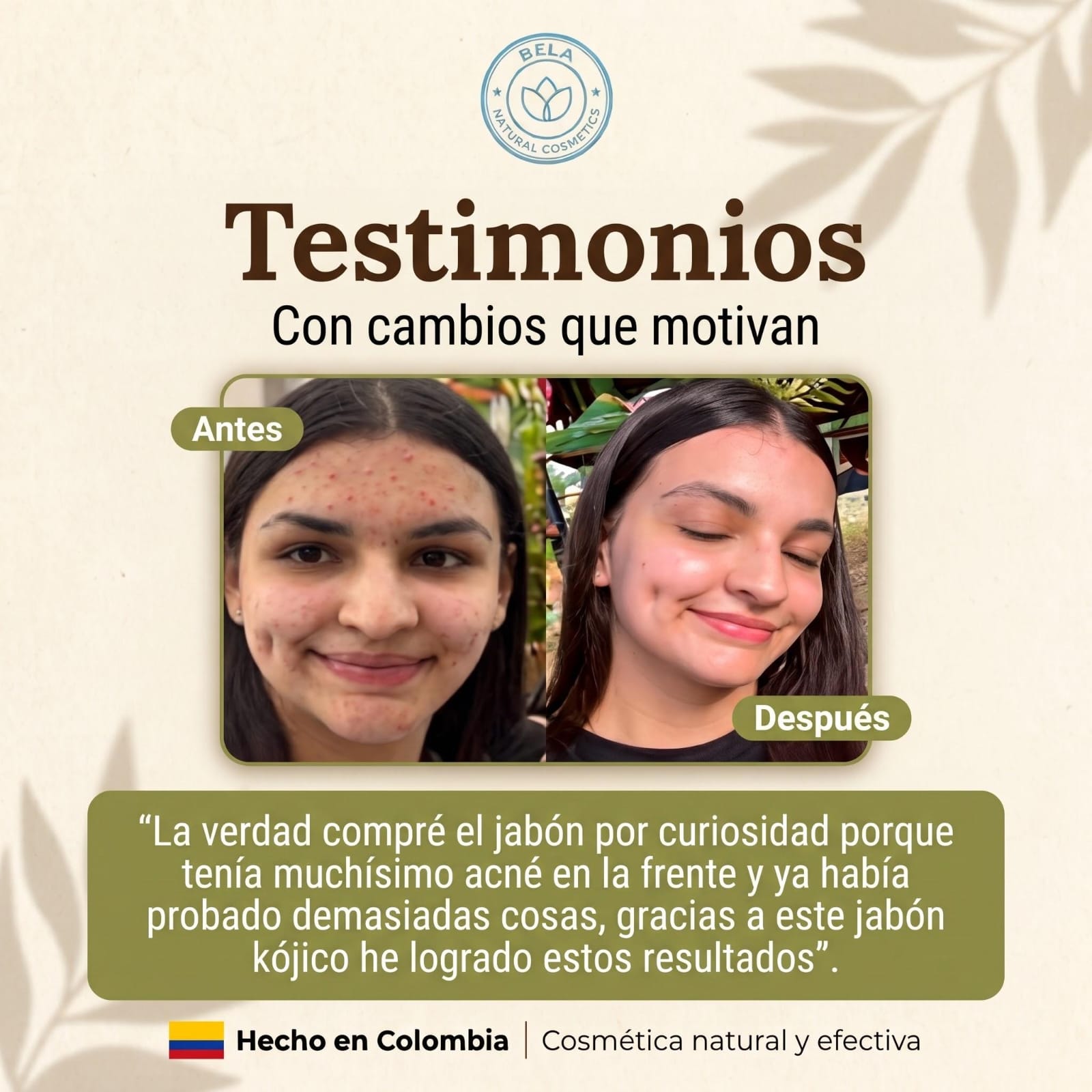 Testimonio de clienta Bela: antes y después del acné en la frente