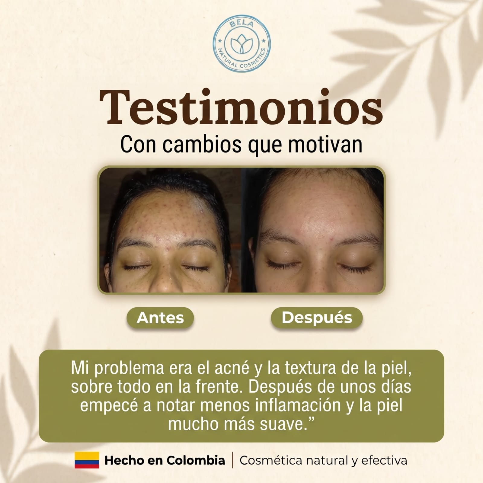 Testimonio de clienta Bela: antes y después de la textura de la piel en la frente