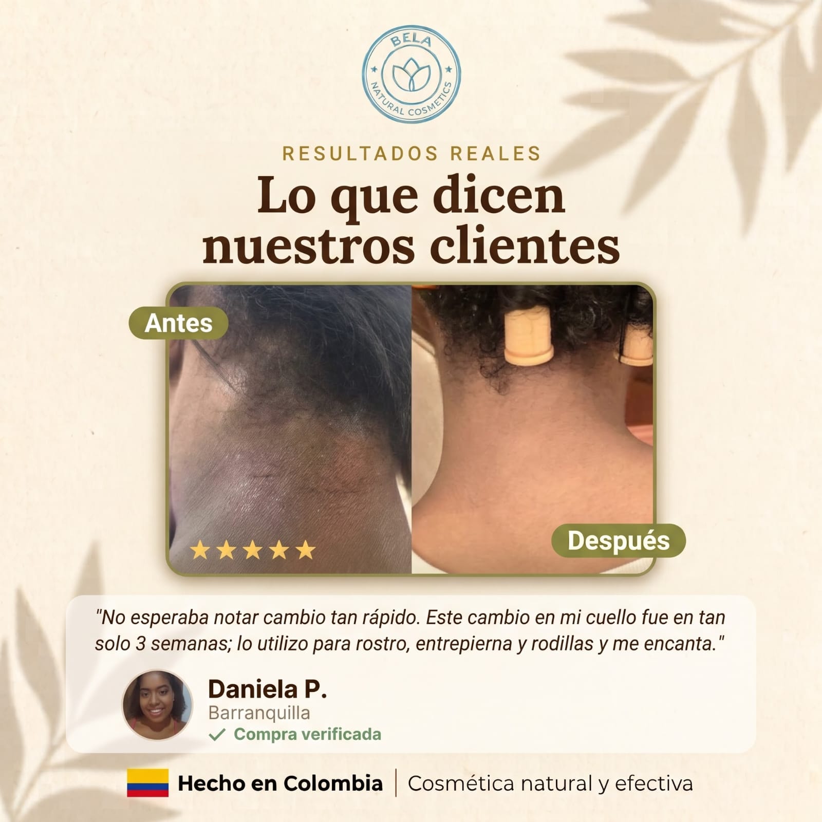 Antes y después de clienta Bela: aclaramiento de manchas en el cuello
